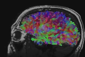 Brain Image Nov 2014